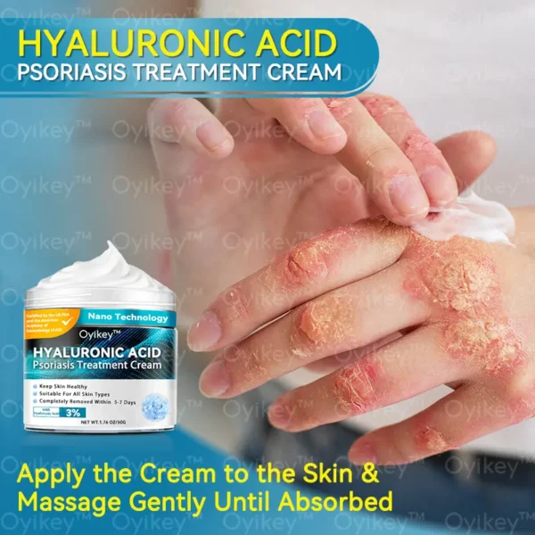 𝐎𝐲𝐢𝐤𝐞𝐲™ Hyaluronic Acid Psoriasis Treatment Cream