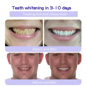 Fivfivgo™ Teeth Restoration Mineral Powder