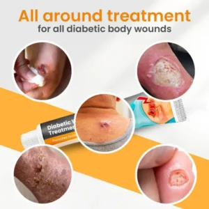 Histone™ Diabetic Wounds Treatment Cream