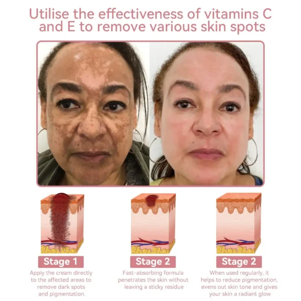 HudRos™ Coenzyme Q10 Collagen Jelly Skin Cream