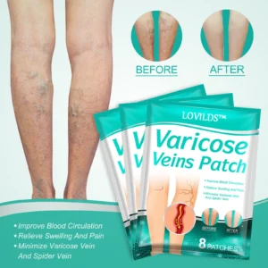 LOVILDS™ Leech Varicose Veins Patch