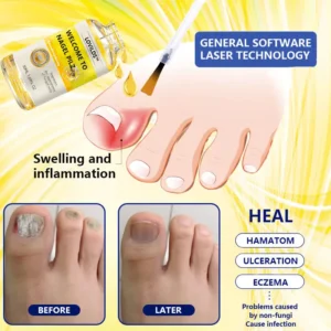 LOVILDS™Wasp Toxin Gray Nail Treatment