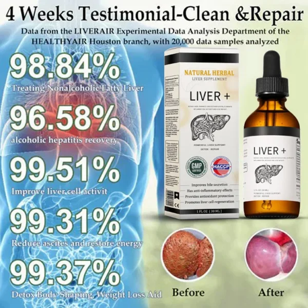 AnnieCare® Natural Herbal Liver Supplement - Powerful Liver Support - Detox & Repair - Lowers Blood Sugar and Lipids - Image 2