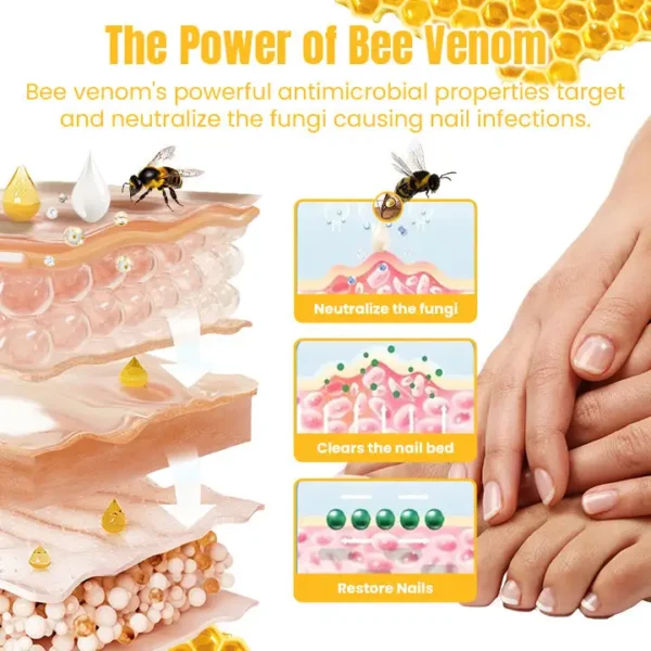 Ceoerty™ FungiGone Bee Venom Nail Cream