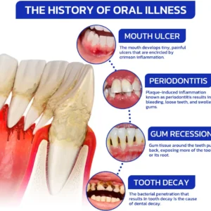 Furzero™ EaseSmile Gums Therapy & Pain Relief Probiotics Bee Venom Chicles