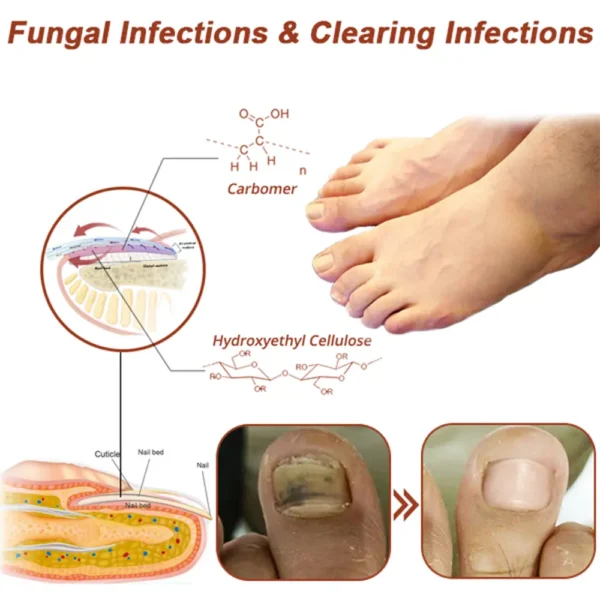 QIAWI™ Revolutionary High-Efficiency Light Therapy Device For Toenail Diseases