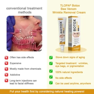 TLOPA®Botox Bee Venom Wrinkle Removal Cream