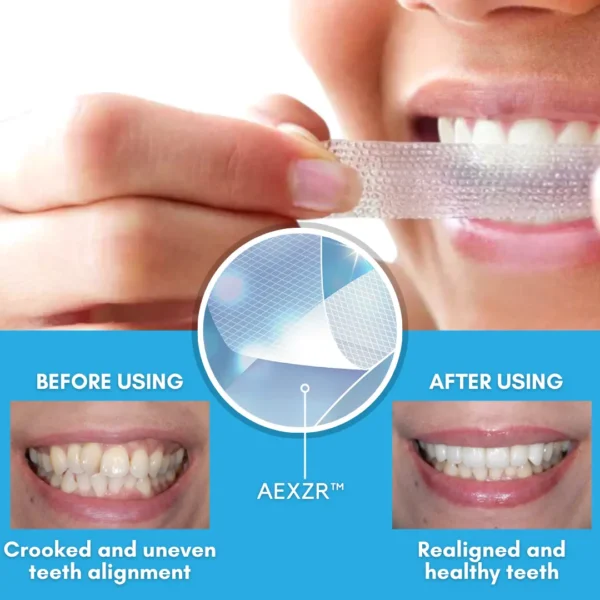 AEXZR™ Teeth Aligner Strips