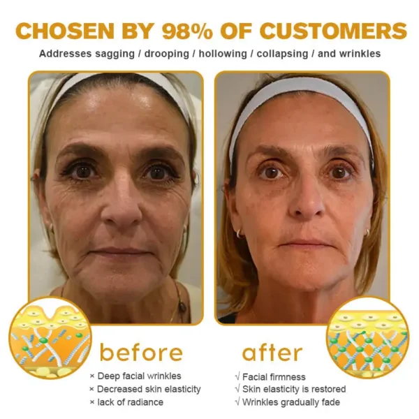 APKAPK™ Botox Bee Venom Wrinkle Removal Cream--Made and Shipped from the USA✅Last Day Promotion 80% OFF