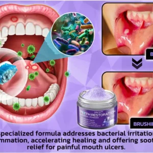 ✅Official Store | BBOJI™ Tooth Health Mineral Powder👄MHRA-Certified (for the treatment of periodontitis and oral ulcers, prevention of tooth loss, and repair of gum recession)